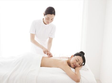 背中に鍼を打つ女性スタッフ